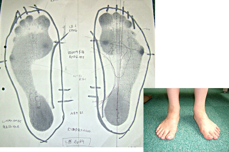 足の画像とフットプリント
