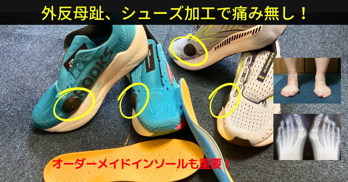 外反母趾、シューズ加工