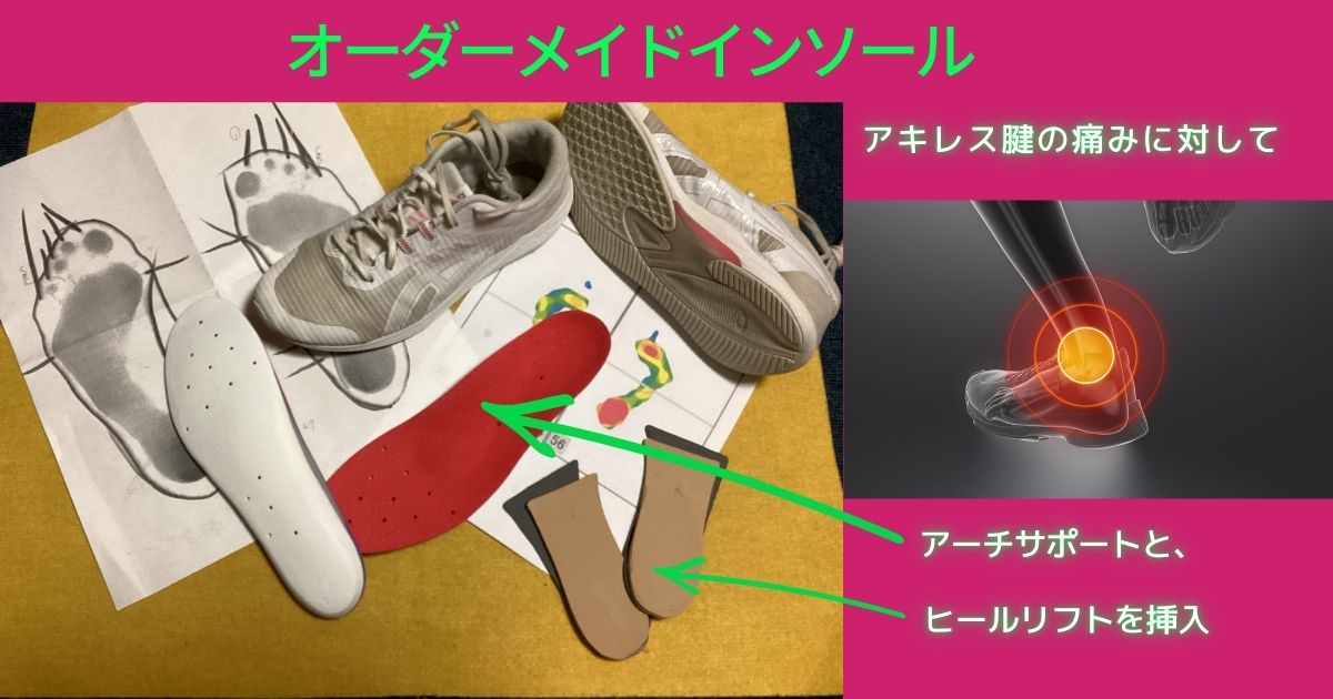 快体健歩オーダーメイドインソール、アキレス腱周囲炎